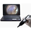 Dino-Lite EarScope MEDL4E 3-500x500