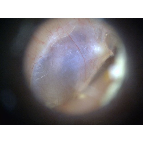 earscope-1 Copy-500x500