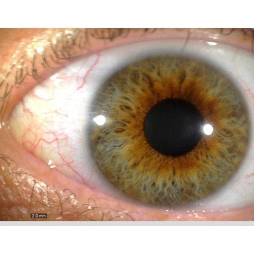 iriscope-2-500x500