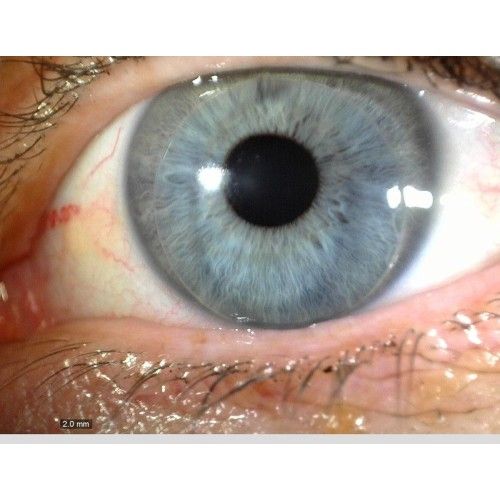 iriscope-4-500x500