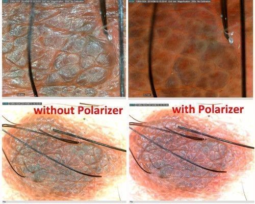 derma_1-500x500