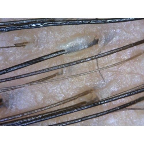 image_602cfee28c1be_trichoscope-4-500x500