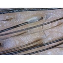 image_602cfee28c1be_trichoscope-4-500x500
